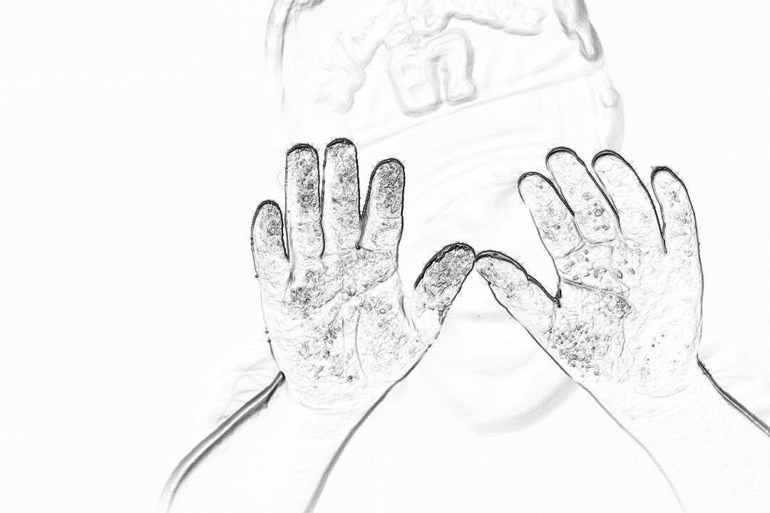 A black and white pencil sketch showing two hands holding an ice pack over the head, with visible frost on fingers, against a plain background. The focus is on closeup details like frozen skin texture and frost patterns. Drawn with detailed shading, soft edges, pencil strokes to add depth, against a stark white backdrop, high contrast, and a monochromatic color scheme emphasizing textures and form.